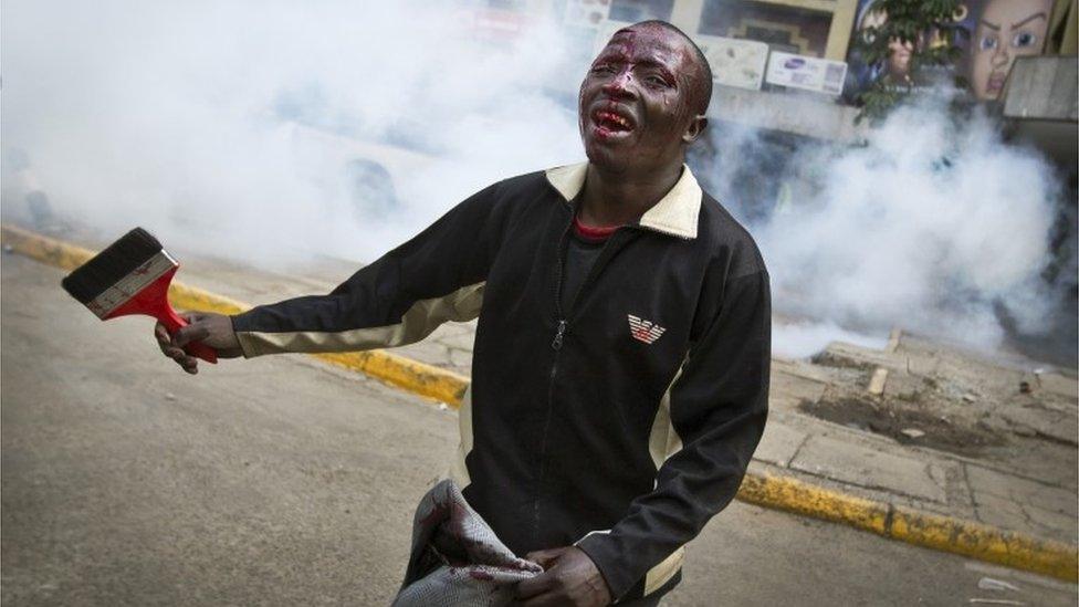 An opposition supporter with a head wound walks past riot police, begging them not to beat him, during a protest in downtown Nairobi, Kenya Monday, May 16, 2016