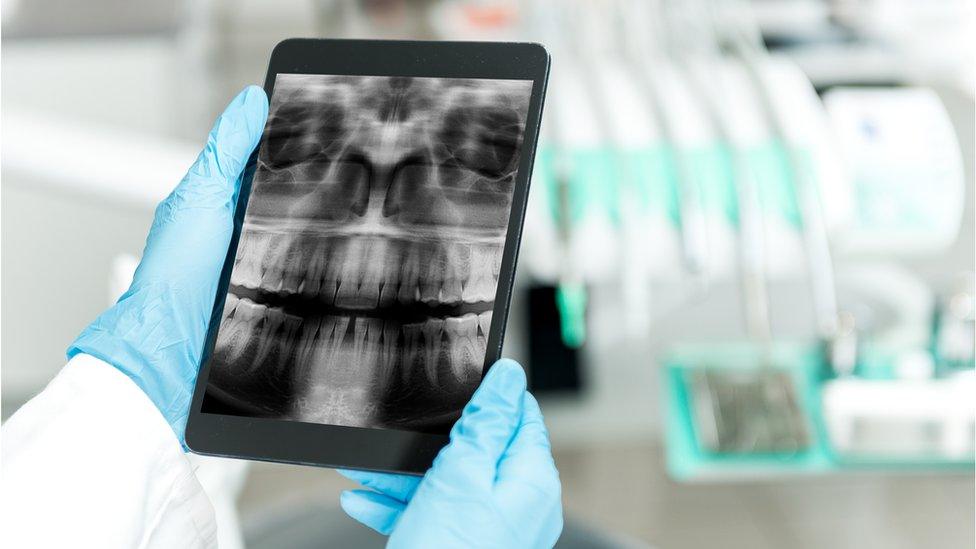 X-ray of teeth and mouth being held by hands wearing blue surgical gloves