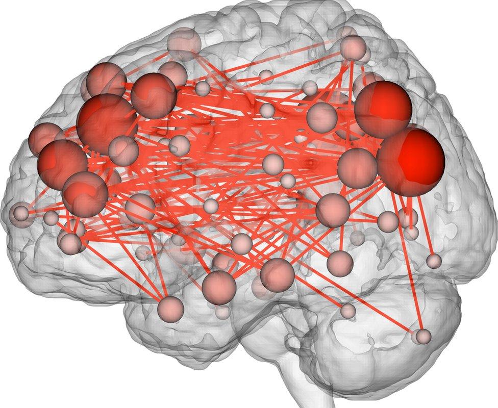 illustration of brain connection map