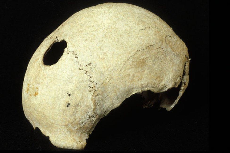 Skull