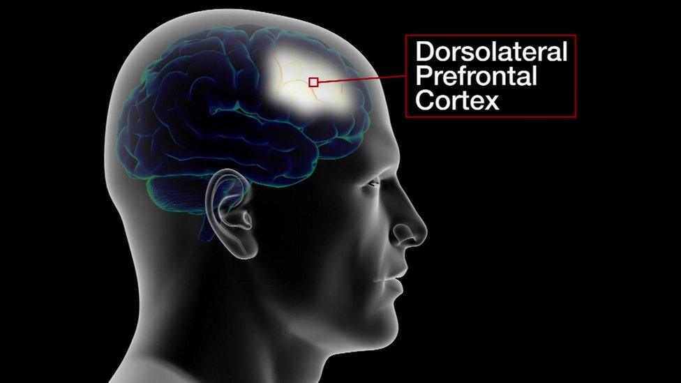 Location of the dorsolateral prefrontal cortex in the brain