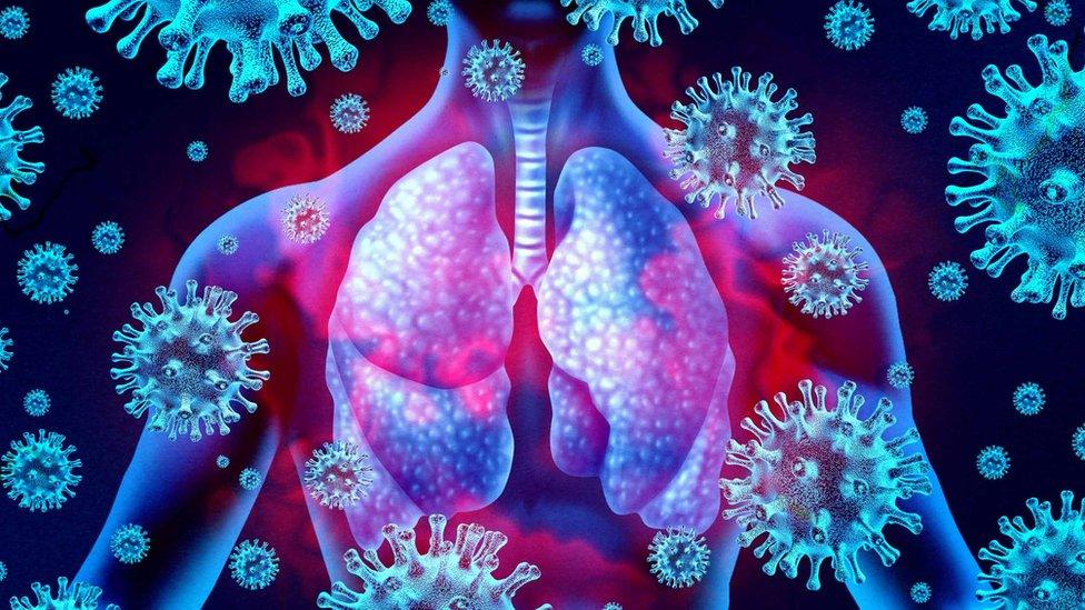 Lungs infected by Covid