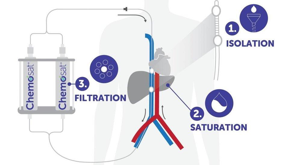 Chemosaturation