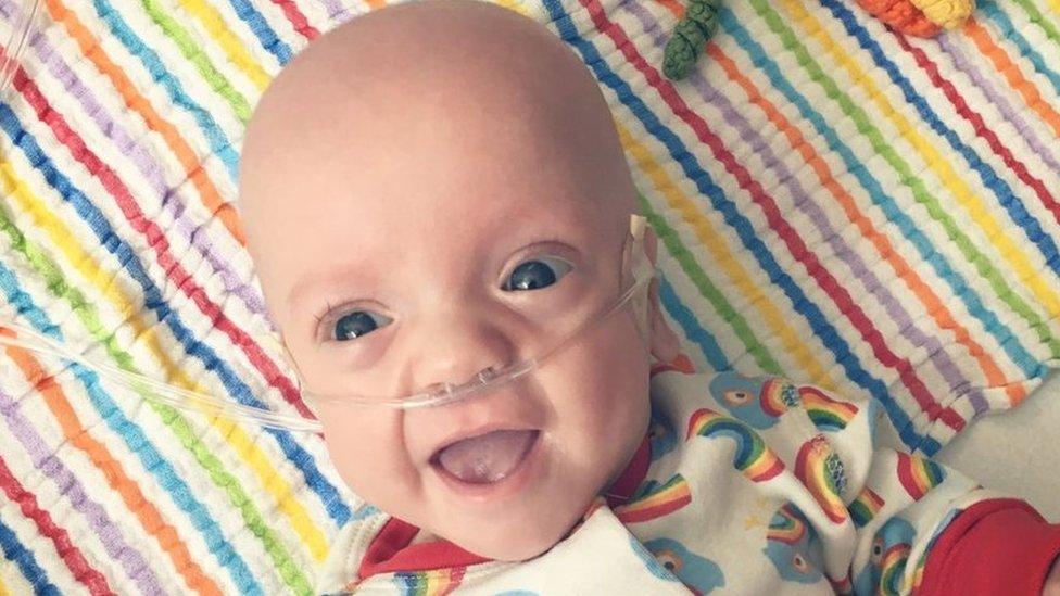 The photo of Arlo Watson used in the Birmingham Children's Hospital campaign