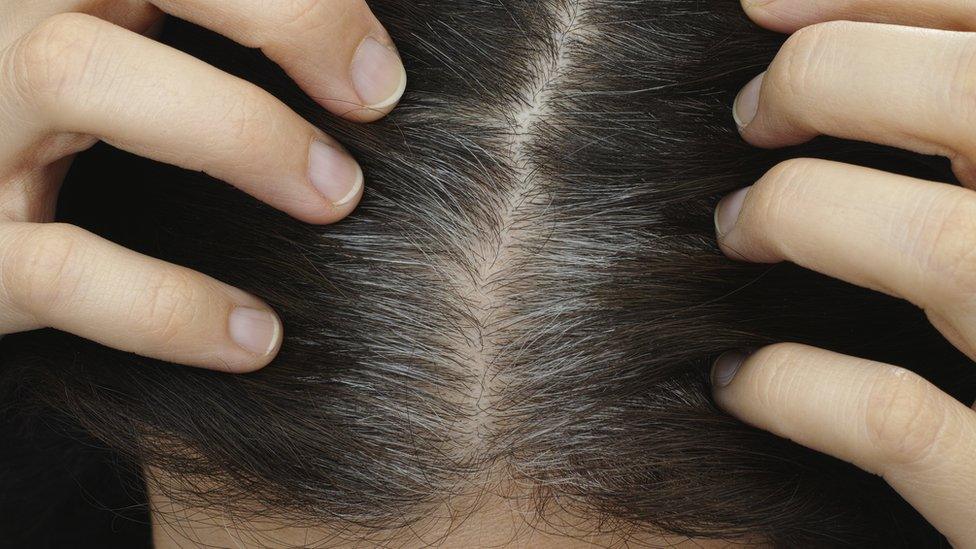 Signs of grey hair at a parting