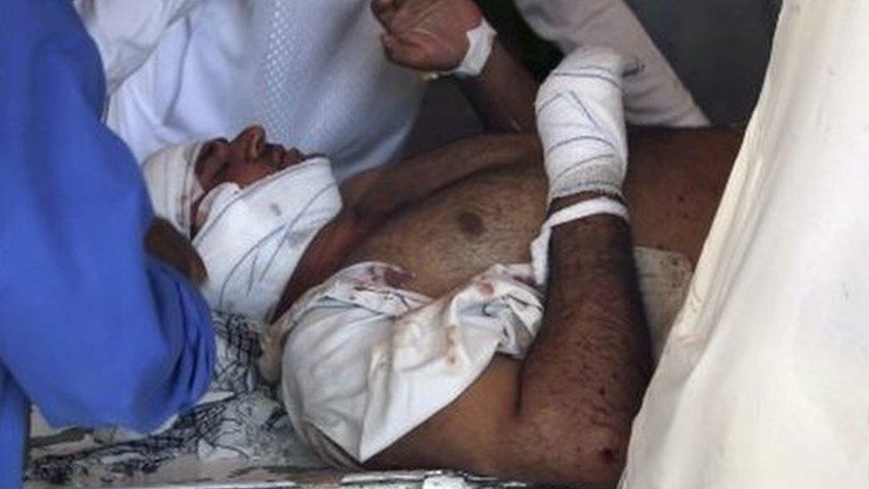 A man who was injured in a twin suicide bomb blasts, that targeted girl"s schools, receive medical attention at a hospital in Jalalabad, Afghanistan, 11 September 2018.