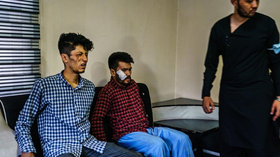 Journalists from the Etilaatroz newspaper, Taqi Daryabi, 22, video editor, left, and Nemat Naqdi, 28, a video journalist, right grimace as they sit on their wounds sustained after Taliban fighters tortured and beat them while in custody after they were arrested for reporting on a women's rights protest in Kabul, Afghanistan, Wednesday, Sept. 8, 2021