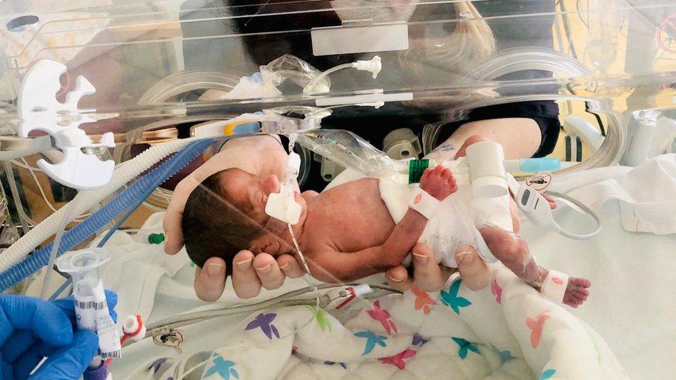 Jacob in his incubator