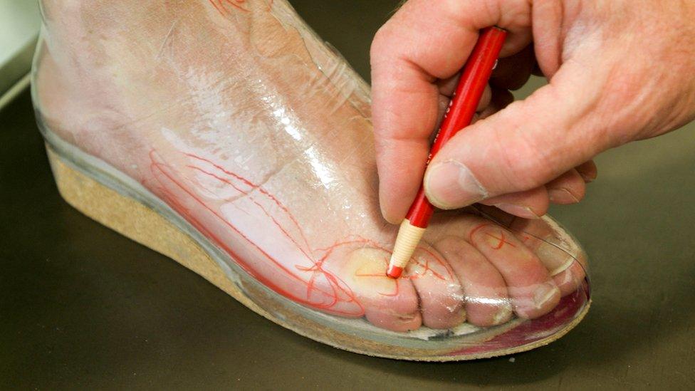 Foot being fitted for orthotic