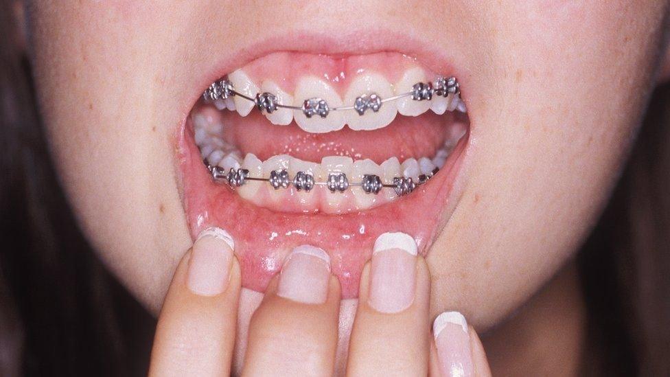 orthodontist