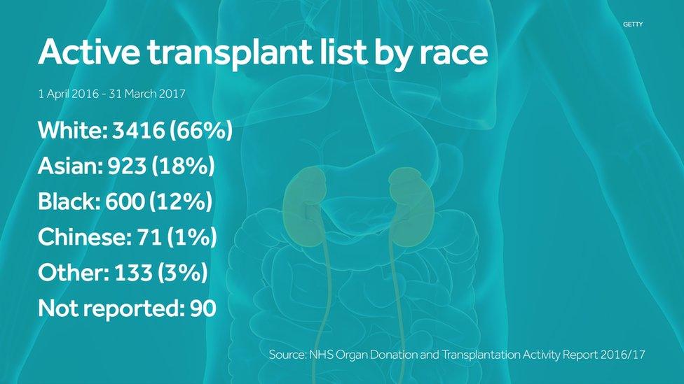 A fact box on the active transplant list by race