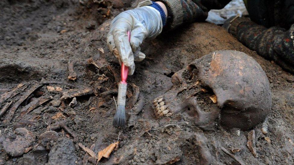 A skull being removed