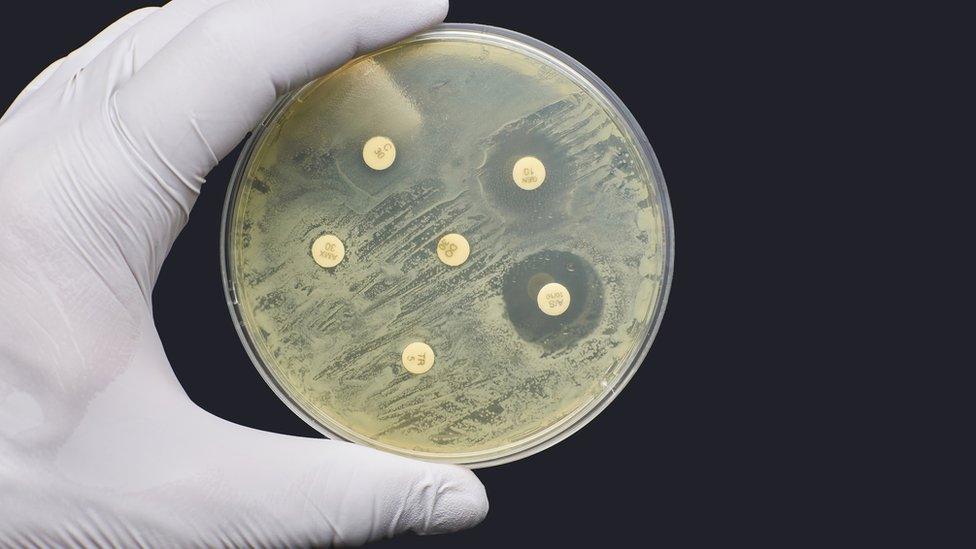 Lab test of antimicrobial resistance