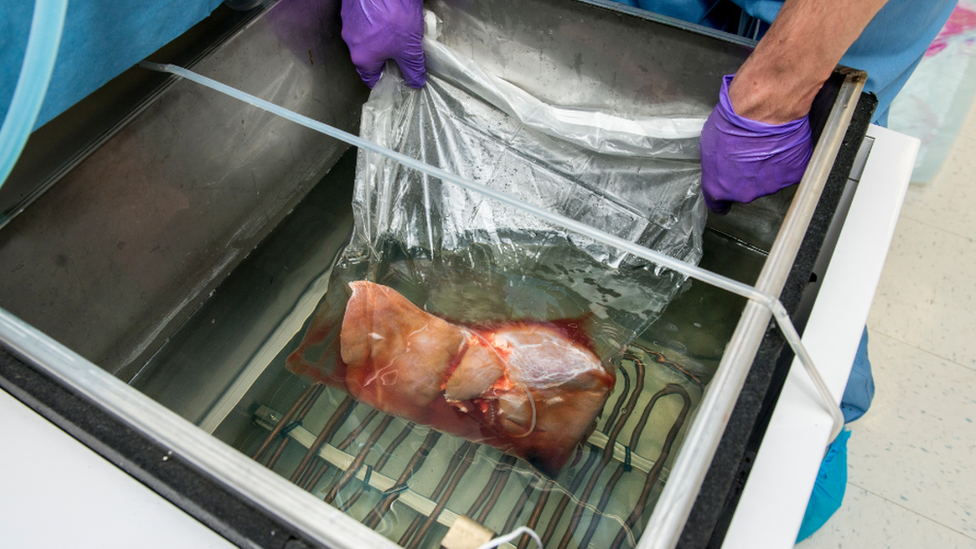 A liver being super-cooled