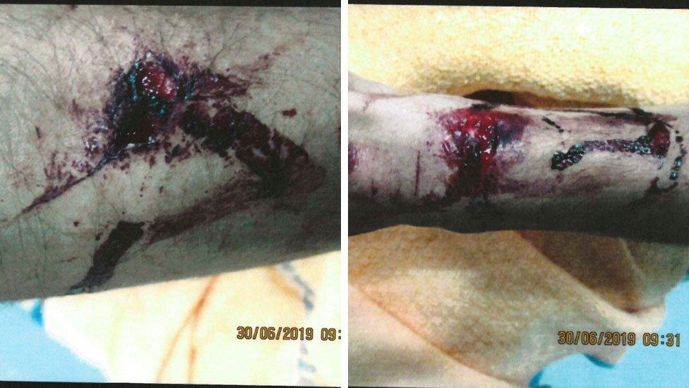 Images of an injury on an arm