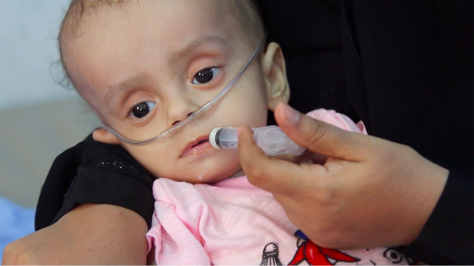 Child in hospital in Yemen