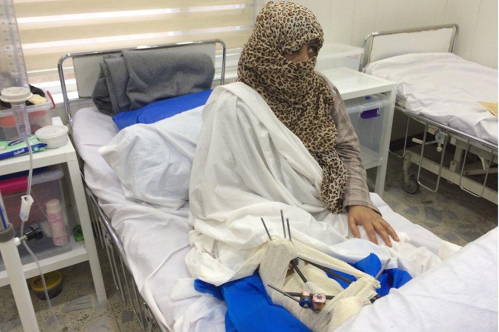 Umm Mohammed sits upright in a hospital bed. Her face is mostly covered by a leopard print headscarf.