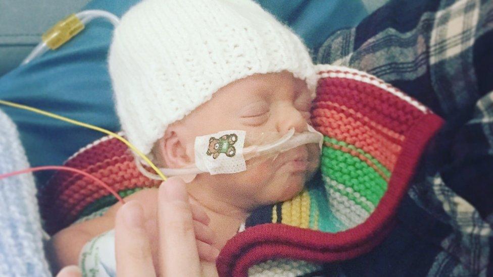 Arlo off the ventilator at 11 weeks old