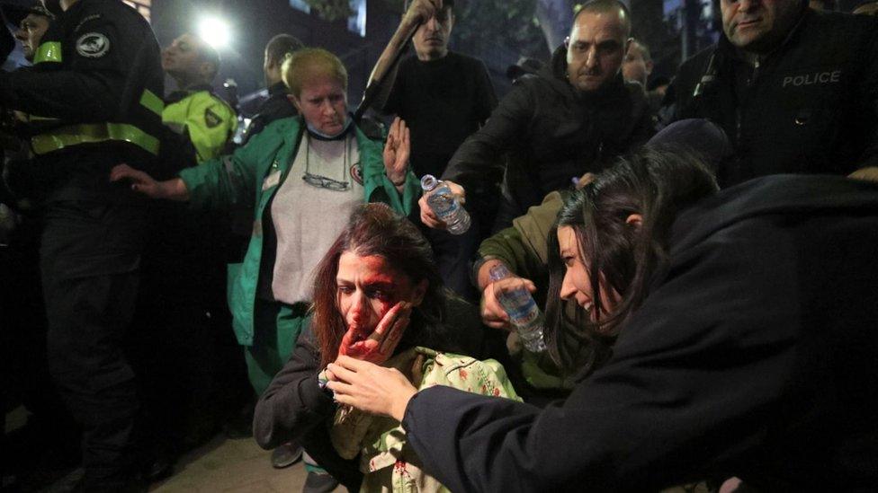 A woman is hurt during an anti-LGBTQ protest in Georgia in November