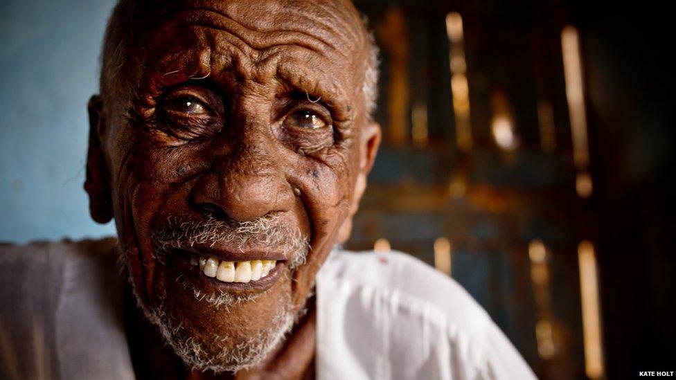 An elderly man, who is found to be suffering from trachoma, poses for a photograph