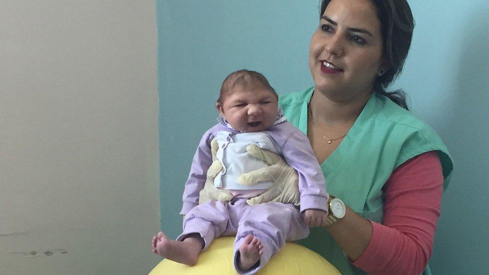 A baby with microcephaly at a physiotherapy session