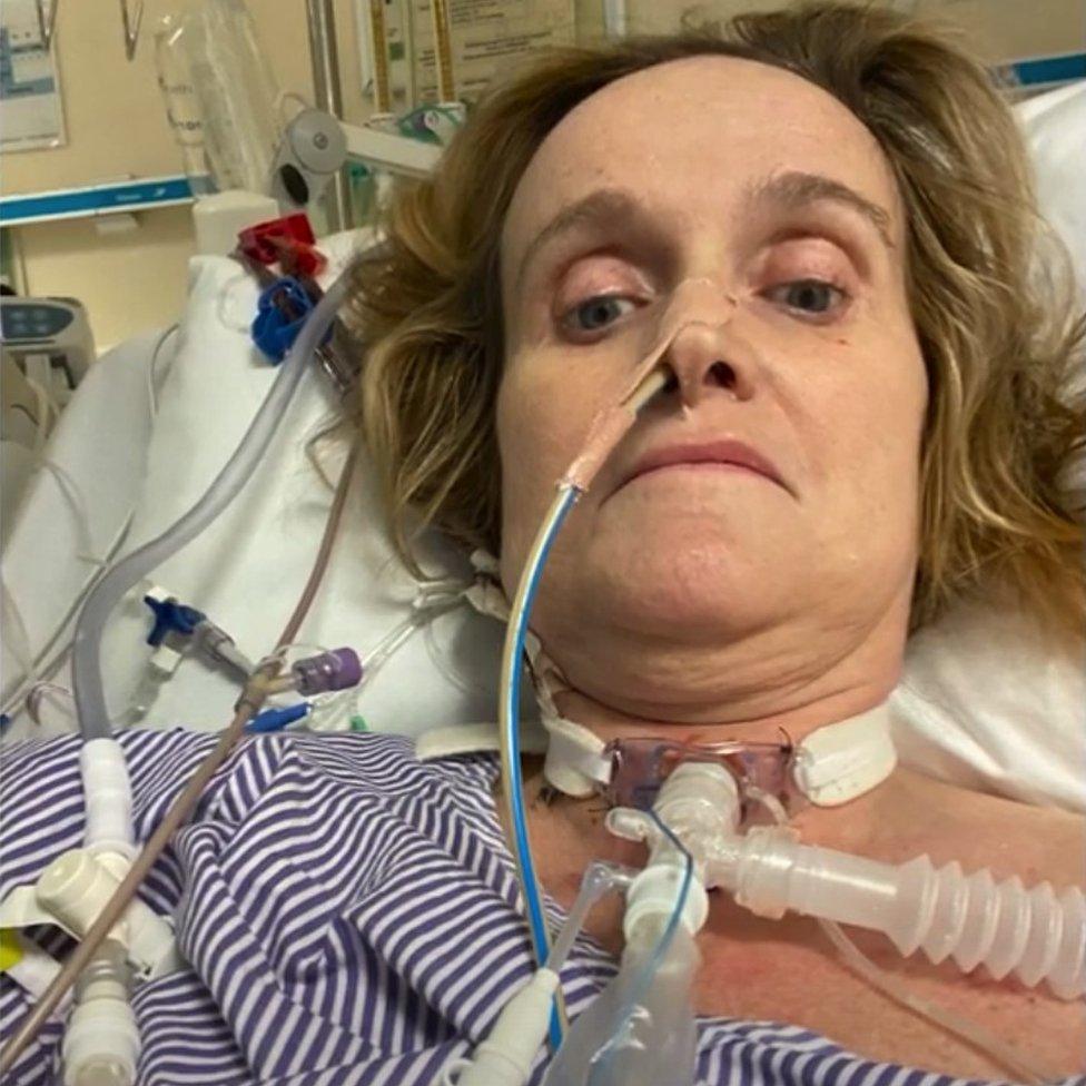 Caroline Jones in intensive care with tubes attached