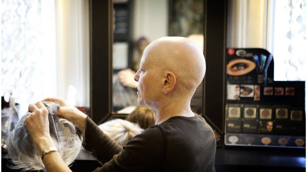 Woman with alopecia putting on a wig