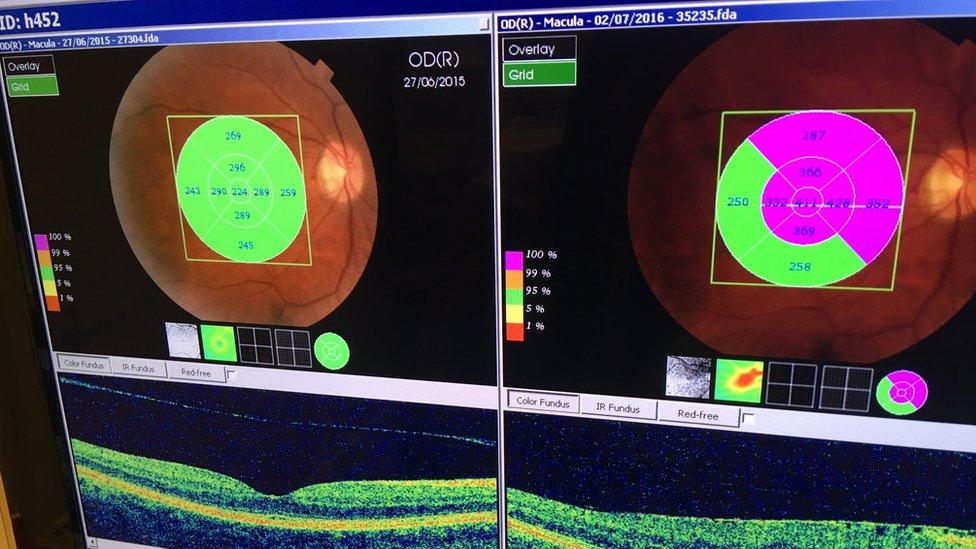 Eye scan