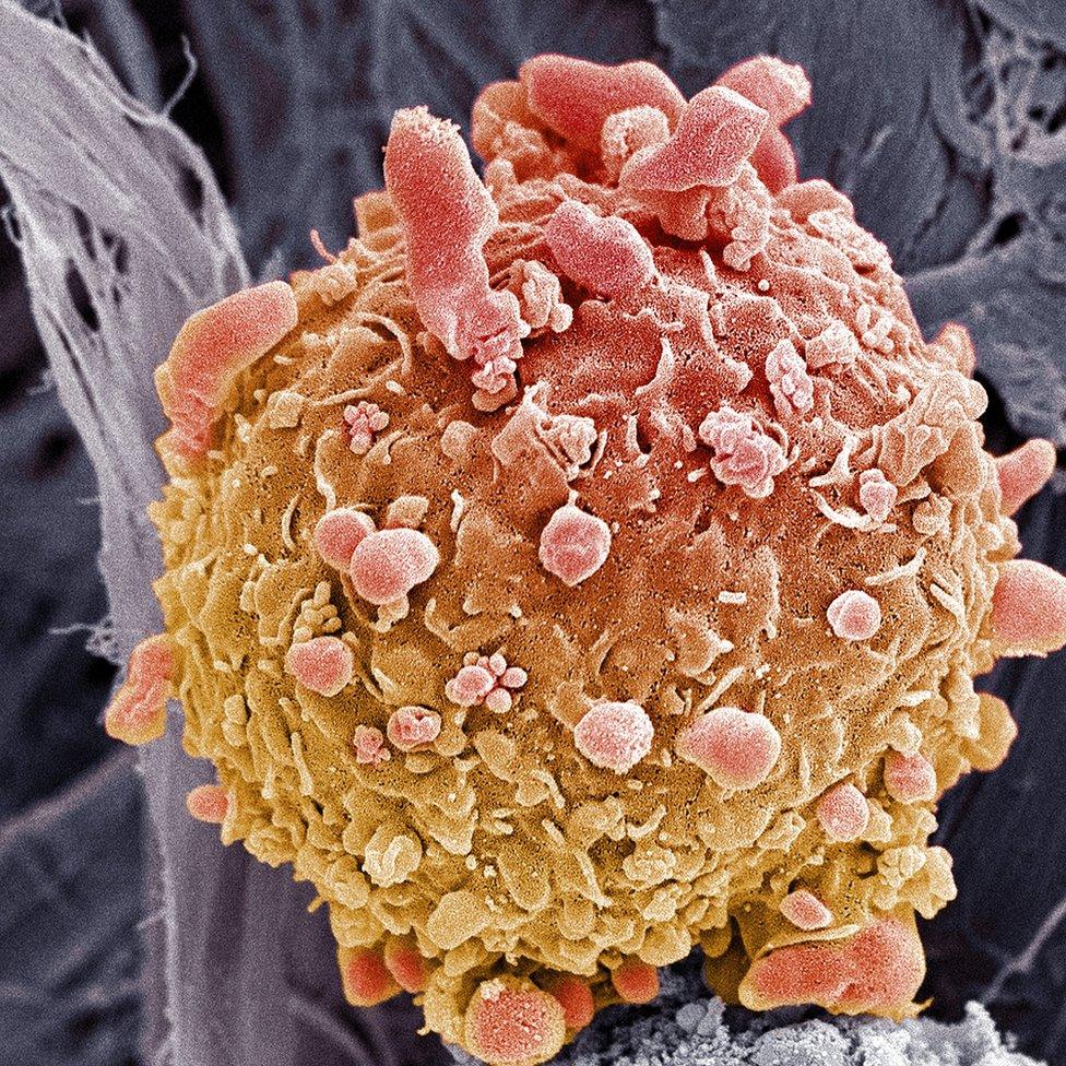 Skin cancer cell