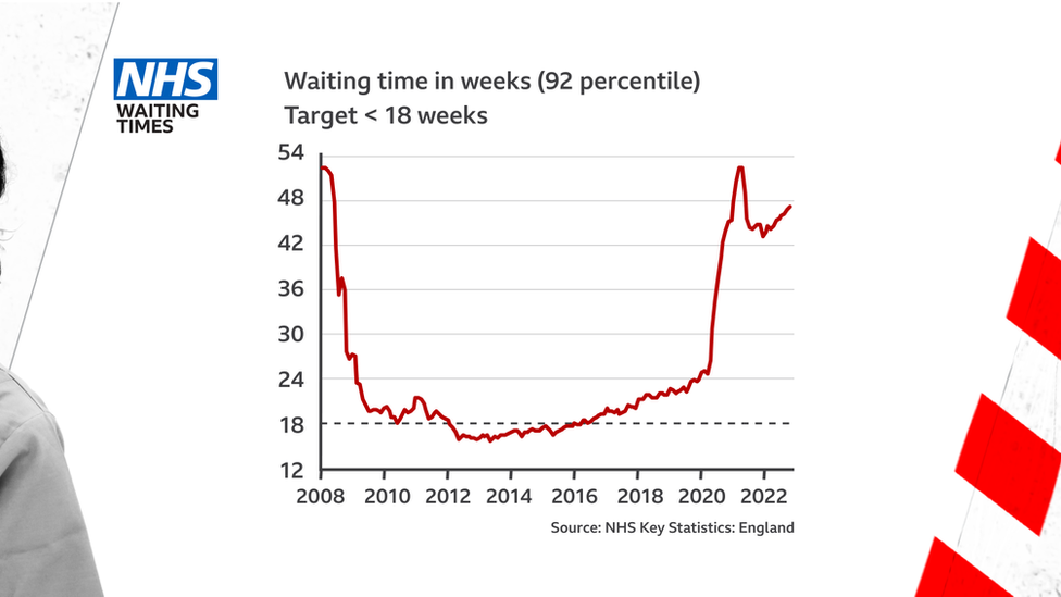 NHS waiting times for operations