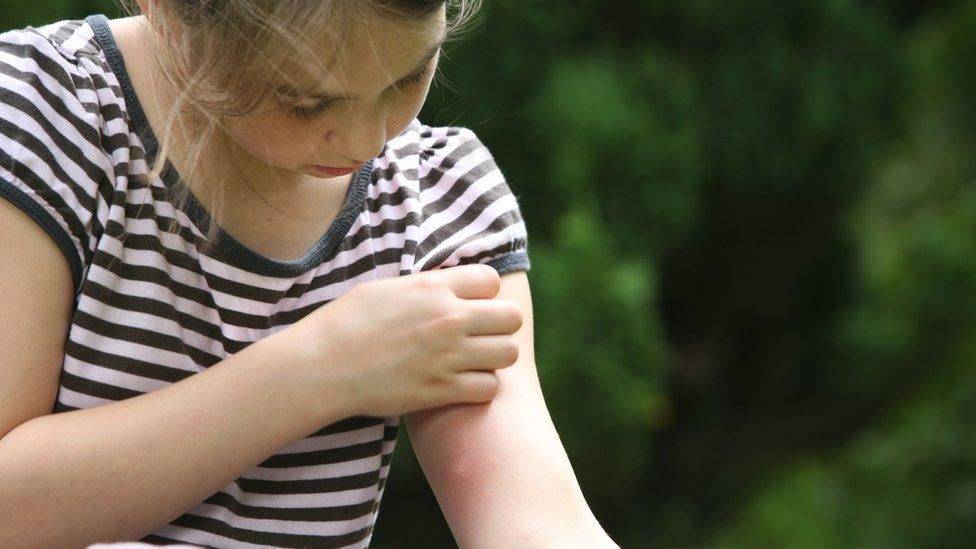girl-with-insect-bite.
