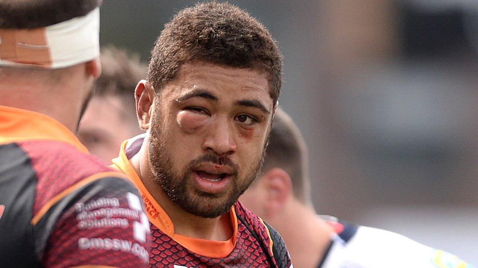 Dragons' Taulupe Faletau sports a swollen eye against Blues