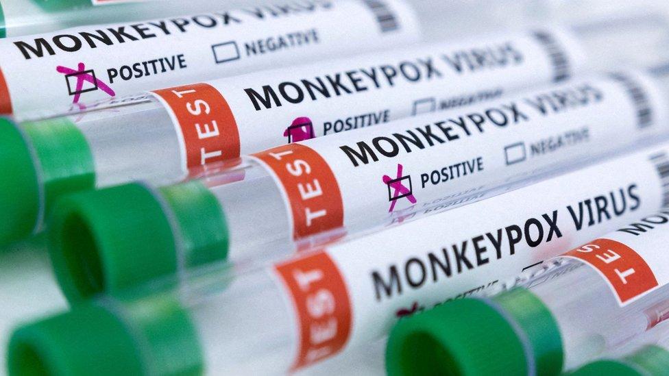 Test tubes labelled "Monkeypox virus positive and negative" in an illustration