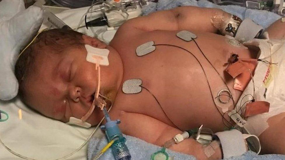 Baby Orson at the special care unit at Singleton Hospital