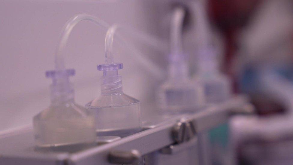 Close-up of filtering tubes attached to a hospital machine