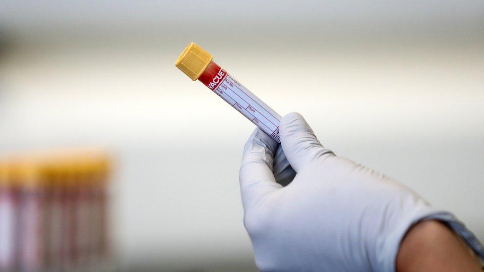 a test tube containing a blood sample