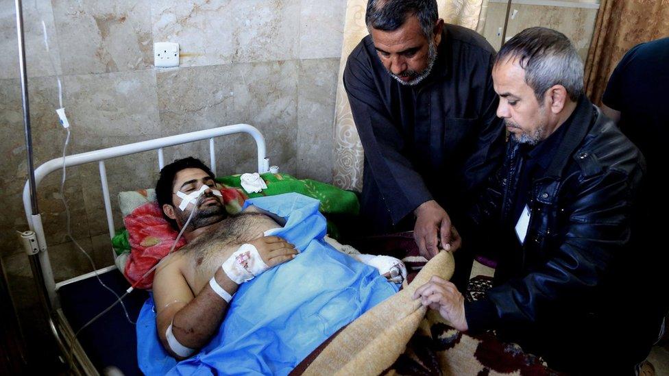 An injured victim of a twin suicide bomb attack in Sadr City, Baghdad, is treated in hospital (29 February 2016)