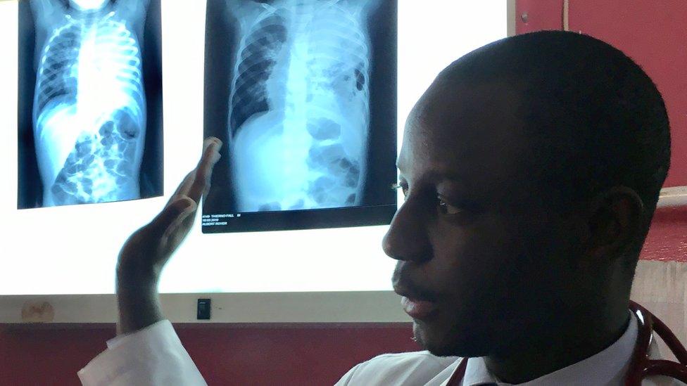 Dr Idrissa Ba pointing at X-rays of lungs