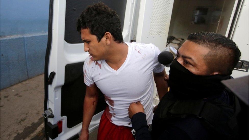 A policeman escorts an inmate injured during a fight at El Porvenir prison, as they arrive at a hospital in Tegucigalpa, Honduras, December 22, 2019