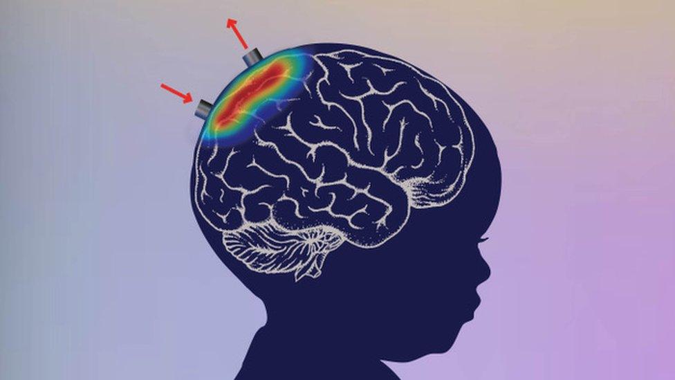 The device shines red and infra-red light into the baby's brain