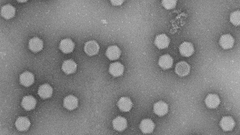 An electron micrograph image of the virus