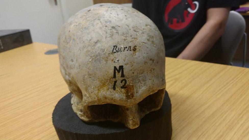 The cast of Robert Burns skull