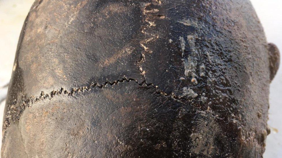 Bronze Age skull found off Mersea Island