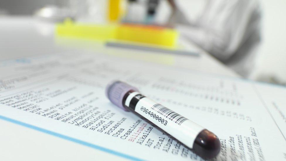 Blood test - vial of blood in lab