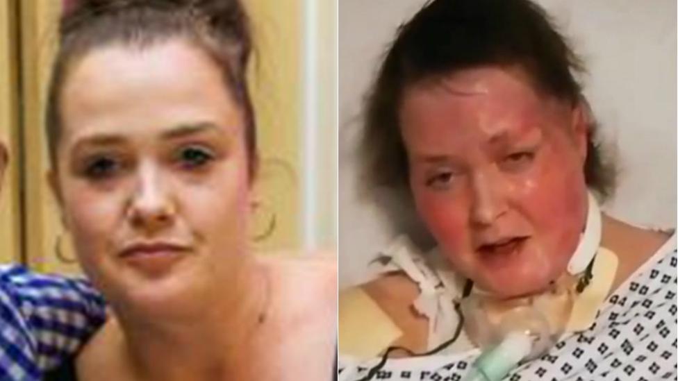 Michelle Pearson before and after the attack