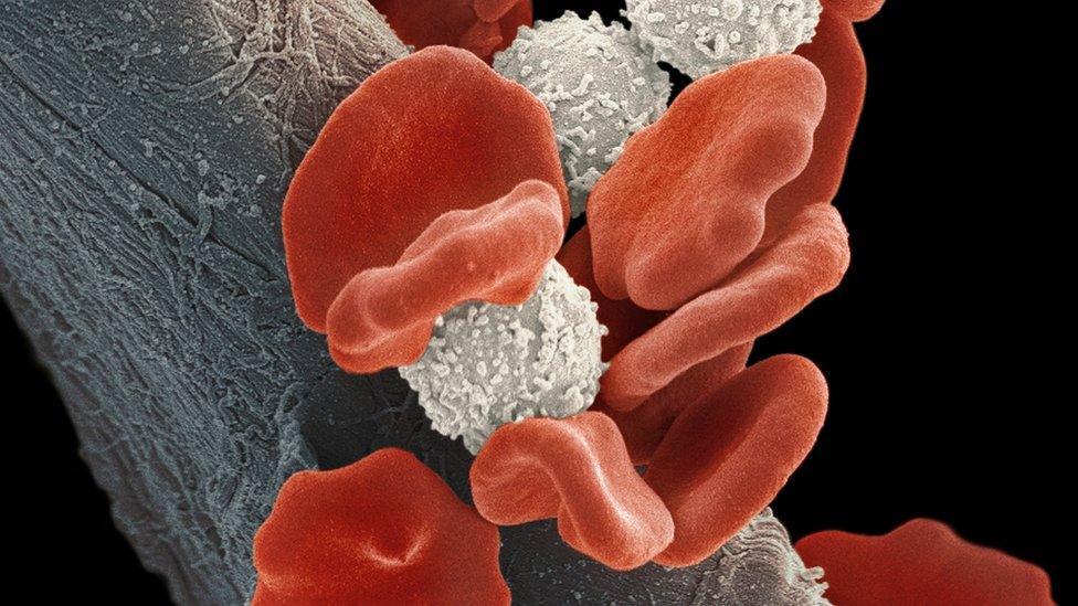 Leukaemia blood cells