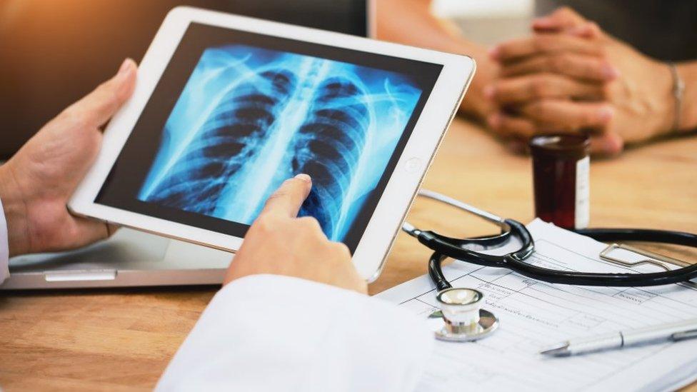 Person points at a lung x-ray on an ipad