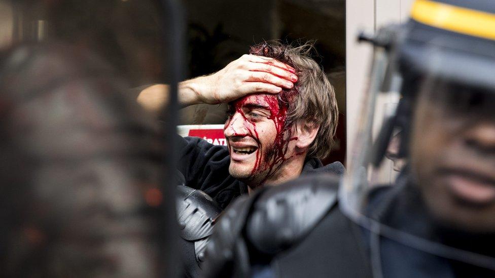 A protester is injured during a demonstration