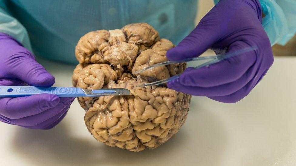 A human brain being used for research