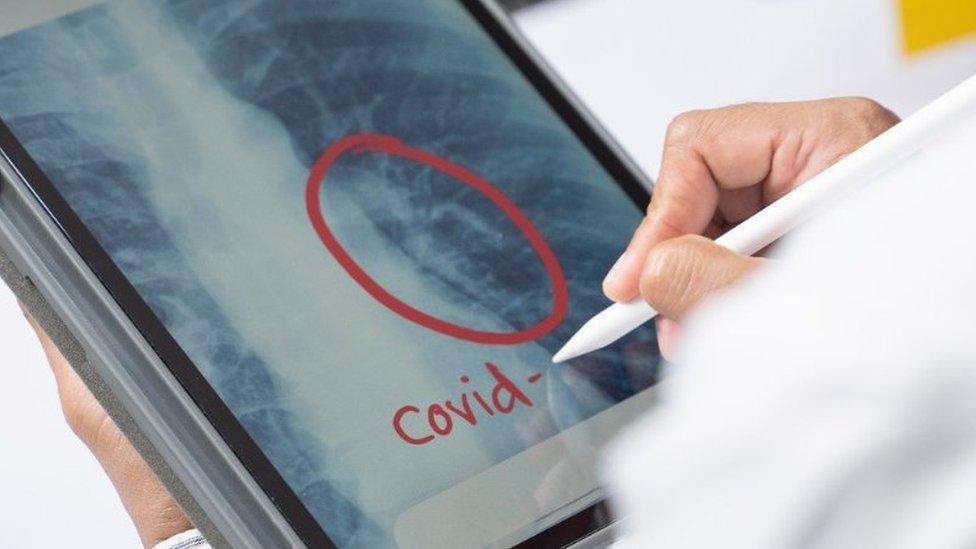 lung x ray on screen with covid circled in red